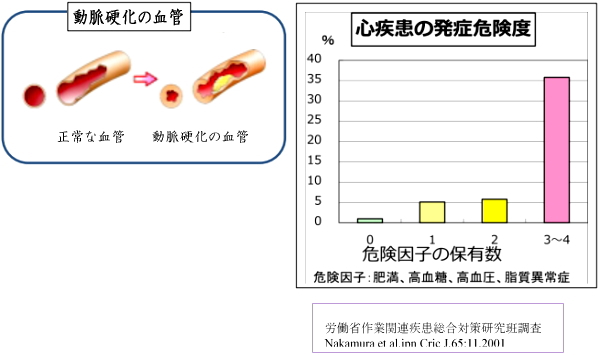 動脈硬化の血管