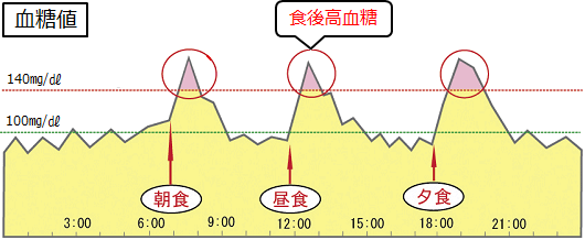 軽症2型糖尿病患者さんにおける1日の血糖値推移